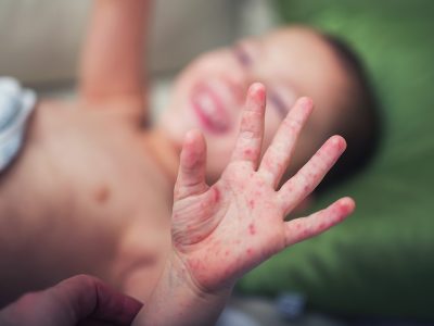 Médicos de Portugal Saúde Pública  Médicos de Portugal Saúde Pública  Médicos de Portugal Saúde Pública  Médicos de Portugal Saúde Pública  Médicos de Portugal Saúde Pública  Médicos de Portugal Saúde Pública  