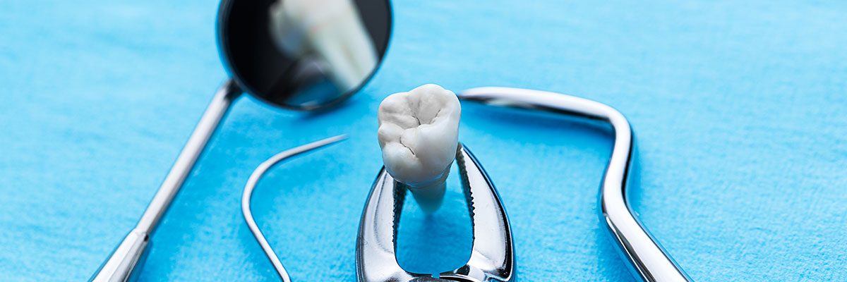 dentes-do-siso-1200x400.jpg